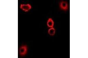 Immunofluorescent analysis of TXNL1 staining in U2OS cells. (TXNL1 anticorps)