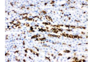 Anti- Band 3 Picoband antibody,IHC(P) IHC(P): Mouse Kidney Tissue