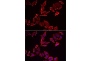 anti-Src Kinase Associated Phosphoprotein 2 (SKAP2) (AA 1-120) antibody
