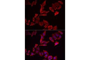 Immunofluorescence analysis of MCF7 cells using SK antibody . (SKAP2 anticorps  (AA 1-120))