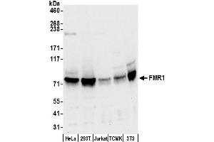 Western Blotting (WB) image for anti-Fragile X Mental Retardation 1 (FMR1) (AA 582-632) antibody (ABIN7450257)