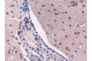 Detection of ADK in Mouse Cerebrum Tissue using Polyclonal Antibody to Adenosine Kinase (ADK)