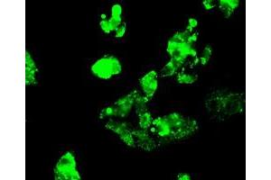 Image no. 3 for anti-Fermitin Family Member 2 (FERMT2) antibody (ABIN1499050)