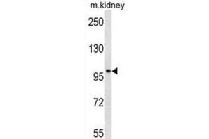 Western Blotting (WB) image for anti-tyrosine Kinase, Non-Receptor, 2 (TNK2) antibody (ABIN3003439) (TNK2 anticorps)