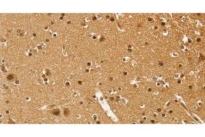 Immunohistochemistry of paraffin-embedded Human brain using PSMC1 Polyclonal Antibody at dilution of 1:40 (PSMC1 anticorps)