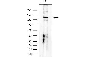 Western blot analysis of lysates from COLO205 cells, using FAK Mouse Monoclonal Antibody at 1/1000 dilution.