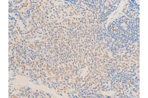 ABIN6267236 at 1/100 staining rat spleen tissue sections by IHC-P.