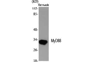 Western Blot analysis of various cells using MyD88 Polyclonal Antibody diluted at 1:2000. (MYD88 anticorps  (Internal Region))