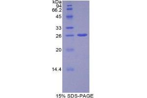 SDS-PAGE (SDS) image for ADAM Metallopeptidase Domain 10 (ADAM10) (AA 420-641) protein (His tag) (ABIN1879112)