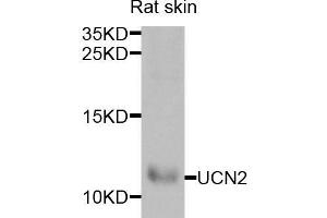 Western blot analysis of extracts of rat skin, using UCN2 antibody (ABIN5973879) at 1/1000 dilution. (Urocortin 2 anticorps)