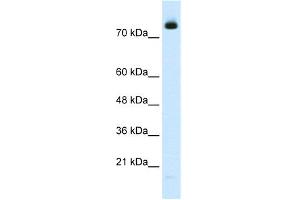 WB Suggested Anti-ZMYM3 Antibody Titration:  2. (ZMYM3 anticorps  (N-Term))