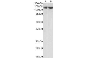 ABIN5539667 (0. (REST anticorps  (Internal Region))