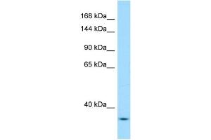 WB Suggested Anti-Yeats2 Antibody Titration: 1. (YEATS2 anticorps  (N-Term))
