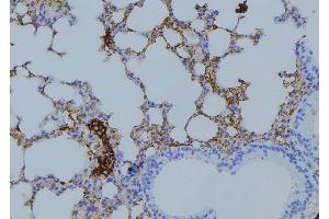 ABIN6275023 at 1/100 staining Mouse lung tissue by IHC-P. (COPZ1 anticorps  (N-Term))