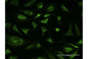 Immunofluorescence of monoclonal antibody to RPN1 on HeLa cell. (RPN1 anticorps  (AA 24-607))