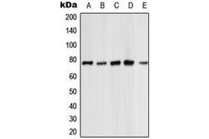 Western blot analysis of PKC zeta expression in HeLa (A), NIH3T3 (B), PC12 (C), rat kidney (D), rat heart (E) whole cell lysates.