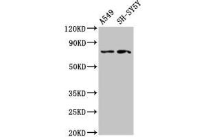 Western Blot Positive WB detected in: A549 whole cell lysate, SH-SY5Y whole cell lysate All lanes: MASP2 antibody at 2. (MASP2 anticorps  (AA 189-314))