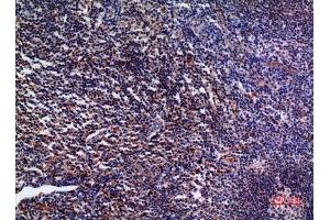 Immunohistochemistry (IHC) analysis of paraffin-embedded Human Tonsil, antibody was diluted at 1:100.