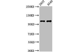 Western Blot Positive WB detected in: 293T whole cell lysate, A549 whole cell lysate All lanes: ICE2 antibody at 4. (NARG2 anticorps  (AA 876-982))