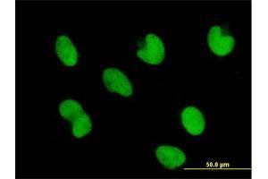Immunofluorescence of purified MaxPab antibody to ZNF165 on HepG2 cell. (ZNF165 anticorps  (AA 1-485))
