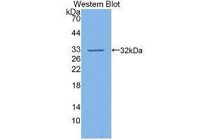 Western blot analysis of the recombinant protein. (VCAM1 anticorps  (AA 369-658))