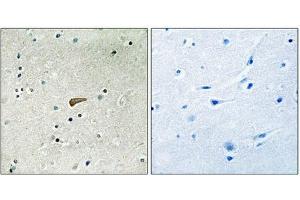 Immunohistochemical analysis of paraffin-embedded human brain tissue using FRS2 (Phospho-Tyr436) antibody (left)or the same antibody preincubated with blocking peptide (right). (FRS2 anticorps  (pTyr436))
