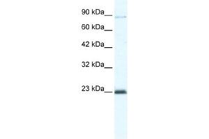 WB Suggested Anti-MCM4 Antibody Titration:  5. (MCM4 anticorps  (C-Term))
