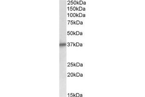 AP32139PU-N Delta-Sarcoglycan antibody staining of Human Heart lysate at 0. (SGCD anticorps  (Internal Region))