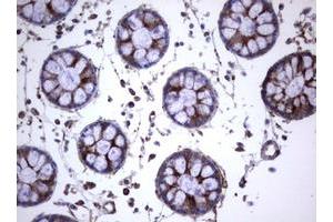 Image no. 21 for anti-Tumor Necrosis Factor Receptor Superfamily, Member 8 (TNFRSF8) (AA 19-379) antibody (ABIN1491084)