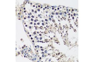 Immunohistochemistry of paraffin-embedded rat testis using C antibody (ABIN6127552, ABIN6137952, ABIN6137953 and ABIN6216977) at dilution of 1:100 (40x lens). (CASC5 anticorps  (AA 1-300))