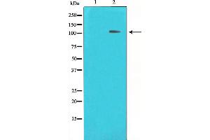 Western blot analysis on HeLa cell lysate using HDAC7 Antibody,The lane on the left is treated with the antigen-specific peptide. (HDAC7 anticorps  (Internal Region))