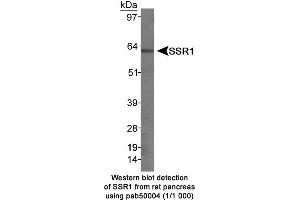 Image no. 1 for anti-Somatostatin Receptor 1 (SSTR1) (C-Term) antibody (ABIN363313) (SSTR1 anticorps  (C-Term))