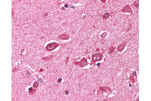 Anti-TRIM38 antibody IHC of human brain, cortex. (TRIM38 anticorps  (C-Term))