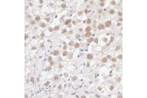 Immunohistochemistry (IHC) image for anti-Flap Structure-Specific Endonuclease 1 (FEN1) (AA 250-300) antibody (ABIN7454602)