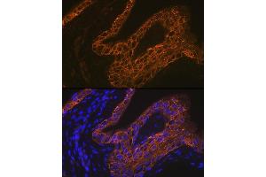 Immunofluorescence analysis of rat bladder using Cytokeratin 13 (KRT13) (KRT13) Rabbit mAb (ABIN7268089) at dilution of 1:100 (40x lens). (Cytokeratin 13 anticorps)