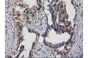 Image no. 16 for anti-Destrin (Actin Depolymerizing Factor) (DSTN) antibody (ABIN1497907)