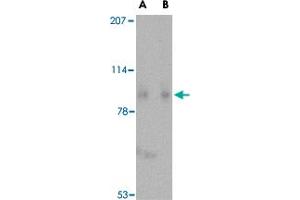Western blot analysis of SLITRK1 in human brain tissue lysate with SLITRK1 polyclonal antibody  at (A) 1 and (B) 2 ug/mL . (SLITRK1 anticorps  (C-Term))