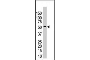 The USP14 polyclonal antibody  is used in Western blot to detect USP14 in HeLa cell lysates . (USP14 anticorps  (N-Term))