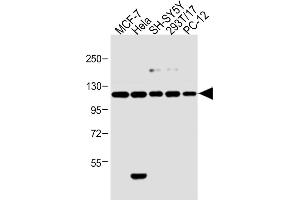 All lanes : Anti-Insulin Receptor R Antibody (N-term) at 1:2000 dilution Lane 1: 293T/17 whole cell lysate Lane 2: Hela whole cell lysate Lane 3: MCF-7 whole cell lysate Lane 4: PC-12 whole cell lysate Lane 5: SH-SY5Y whole cell lysate Lysates/proteins at 20 μg per lane. (Insulin Receptor anticorps  (N-Term))