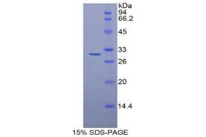 SDS-PAGE (SDS) image for Histone Deacetylase 6 (HDAC6) (AA 565-813) protein (His tag) (ABIN2125217) (HDAC6 Protein (AA 565-813) (His tag))