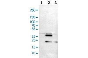 Western blot analysis of Lane 1: NIH/3T3 cell lysate, Lane 2: NBT-II cell lysate, and Lane 3: PC-12 cell lysate with CRKL polyclonal antibody . (CrkL anticorps  (AA 125-301))