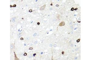 Immunohistochemistry of paraffin-embedded Rat brain using IGFBP5 Polyclonal Antibody at dilution of 1:100 (40x lens). (IGFBP5 anticorps)