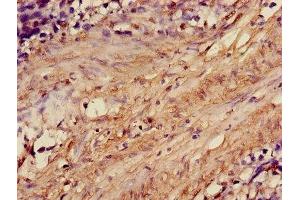 Immunohistochemistry of paraffin-embedded human smooth muscle tissue using ABIN7143116 at dilution of 1:100