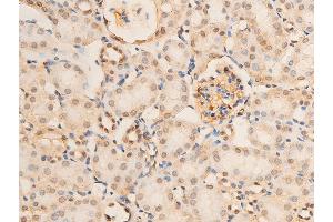 ABIN6267070 at 1/100 staining mouse kidney tissue sections by IHC-P. (NF-kB p65 anticorps  (pSer536))