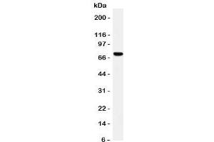 Westrn blot testing of HIF-3 alpha antibody and rat brain tissue lysate. (HIF3A anticorps  (C-Term))
