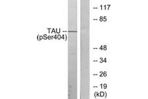 Western blot analysis of extracts from 293 cells treated with UV, using Tau (Phospho-Ser404) Antibody. (tau anticorps  (pSer721))