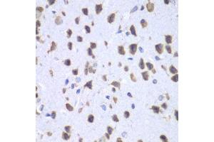 Immunohistochemistry of paraffin-embedded mouse brain using UPF1 antibody.