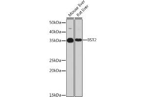 Western blot analysis of extracts of various cell lines, using BST2 Rabbit mAb (ABIN7265893) at 1:1000 dilution. (BST2 anticorps)