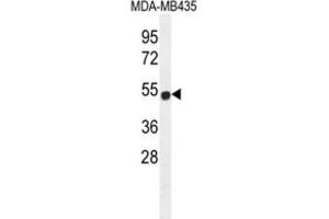 Western Blotting (WB) image for anti-Zinc Finger Protein 286B (ZNF286B) antibody (ABIN2996342)