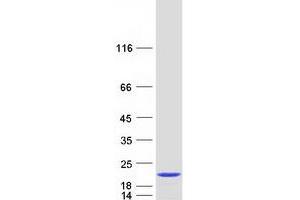 Validation with Western Blot